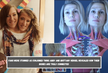 Fans were stunned as conjoined twins Abby and Brittany Hensel revealed how their bodies are truly connected